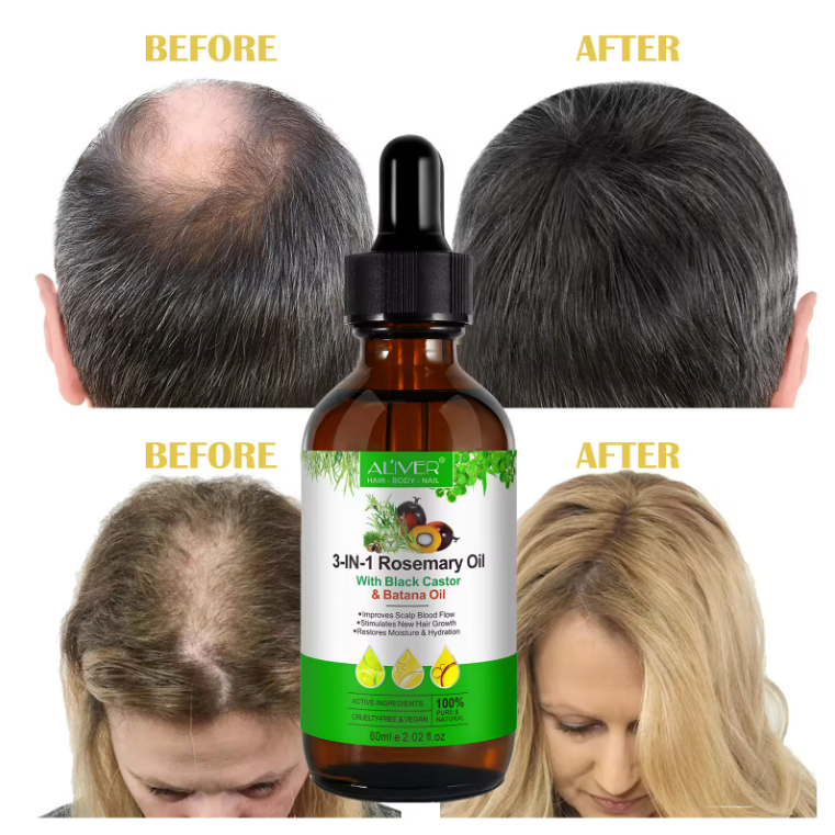 Hair Loss 3 In 1 Rosemary Essential Oil with Black Castor Batana Oil